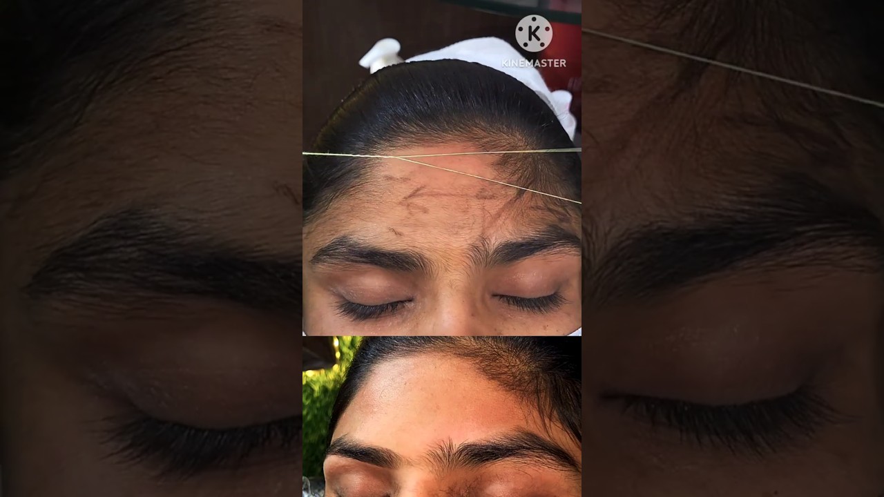 forehead threading | eyebrow forehead