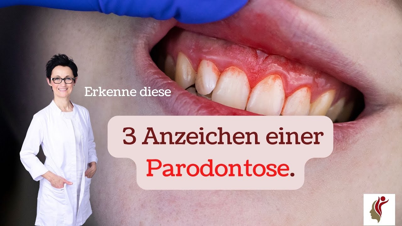 3 Anzeichen für Parodontose
