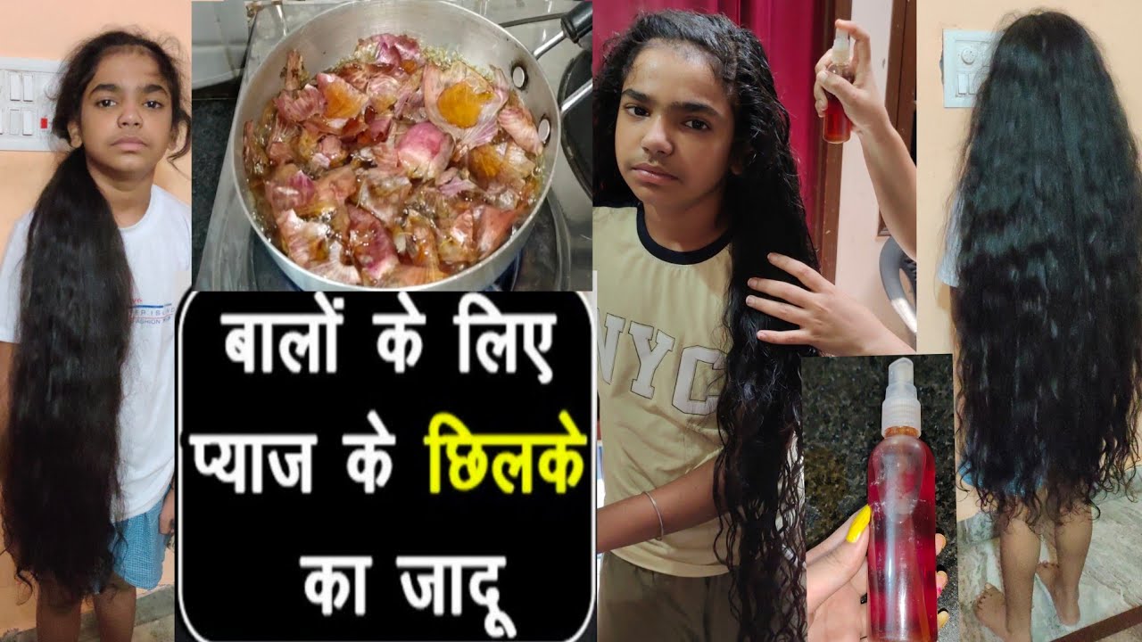You Will Never Throw Away Onion Peels Again/Hair Growth Toner/Jashan Long Hair Sikh Boy