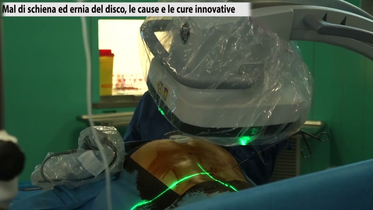 Dott. Trincia Giuseppe | Mal di schiena ed ernia del disco, le cause e le cure innovative