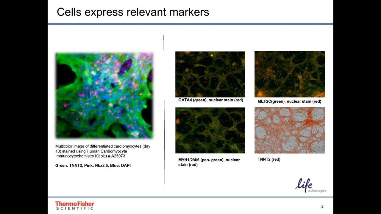 PSC Cardiomyocyte Differentiation Kit &ndash; PSCs to cardiomyocytes in three steps