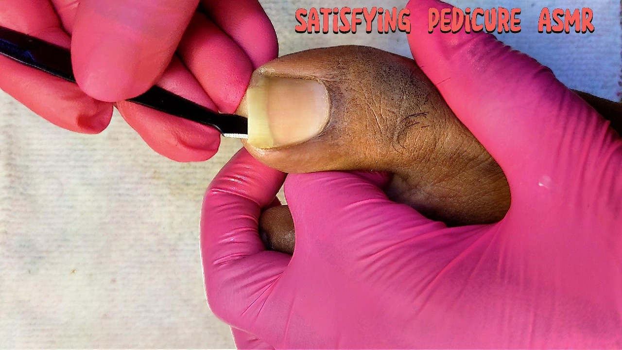 EXTREME Big Toenail Cleaning 😱 | Satisfying Pedicure ASMR Transformation 👣✨