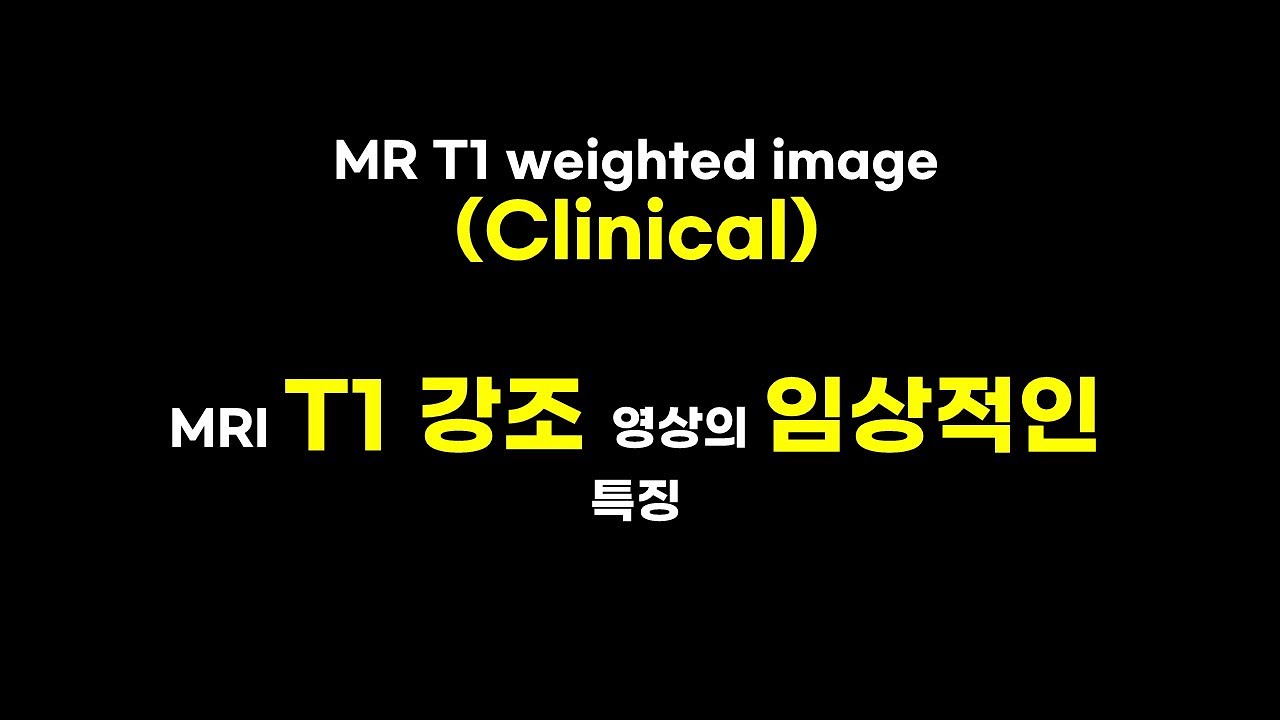 T1 weighted image의 임상적인 특징 #MRI #자기공명영상 #의료영상 #방사선 #의료기기 #의공학