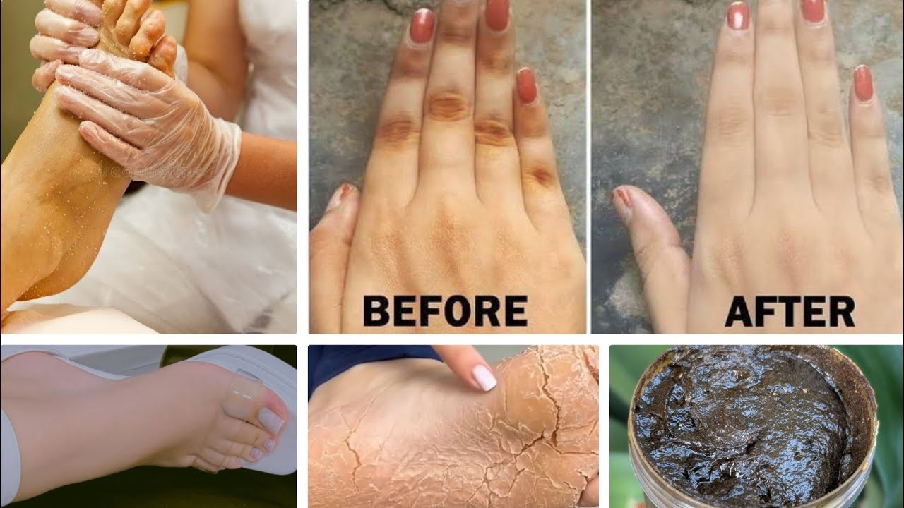 Watan sirta lugaha iyo gacmaha lagu cadeyo skin lightening