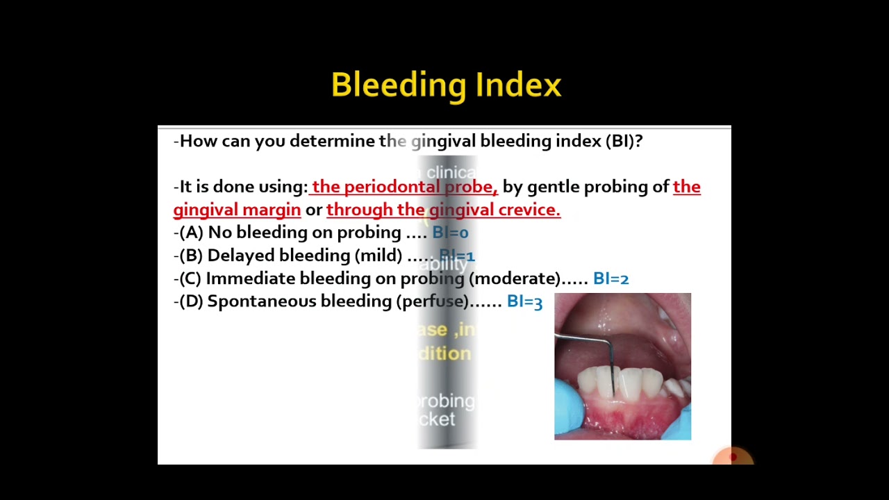 Periodontal Chart
