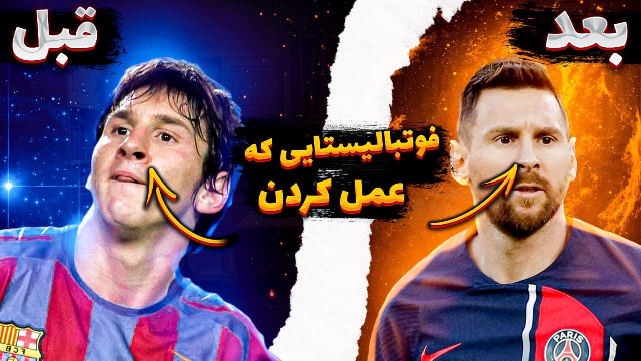 فوتبالیستایی که جراحی زیبایی انجام دادن
