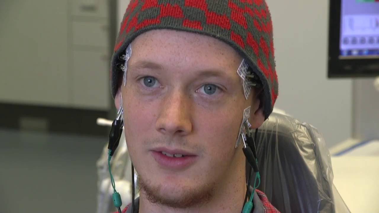 Did WISDOM TEETH extractions cause his TMD?!