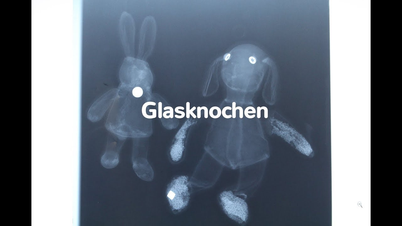 Glasknochen