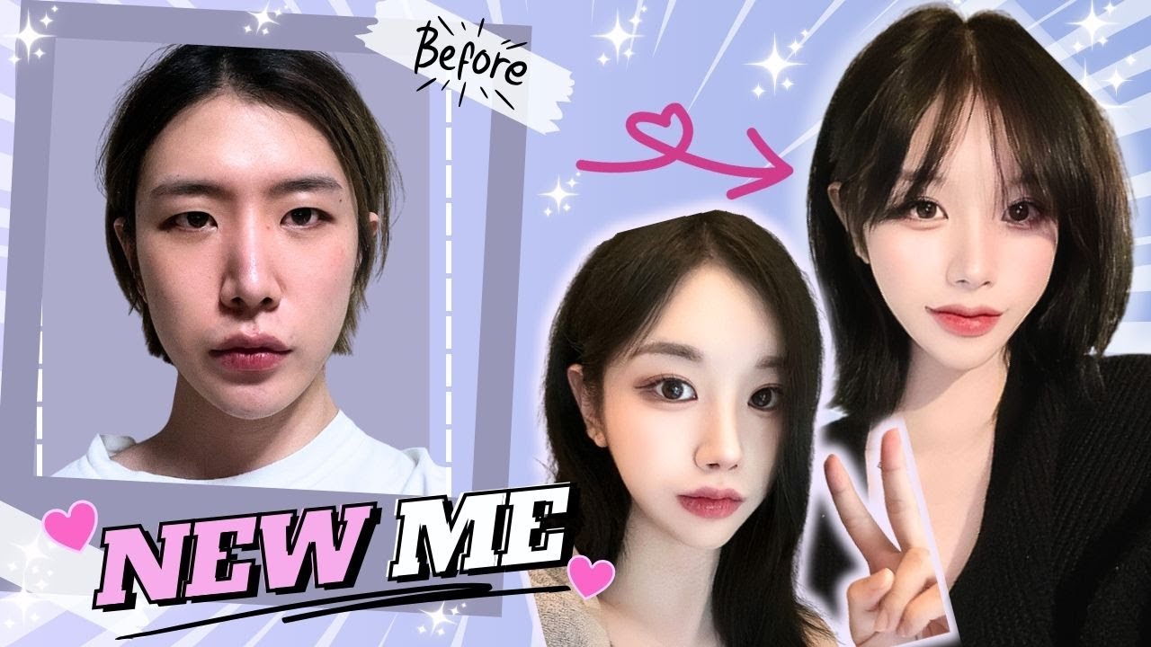 [Plastic Surgery Korea}] Transgender Surgery at DA! Journey to a New life