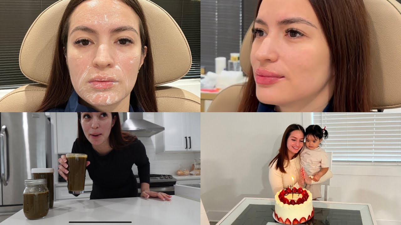 MI HICE BOTOX, FILLER & LIP FILLER! MI MEJOR CUMPLEAÑOS! SUMAMENTE AGRADECIDA!! GRACIAS GRACIAS!! 