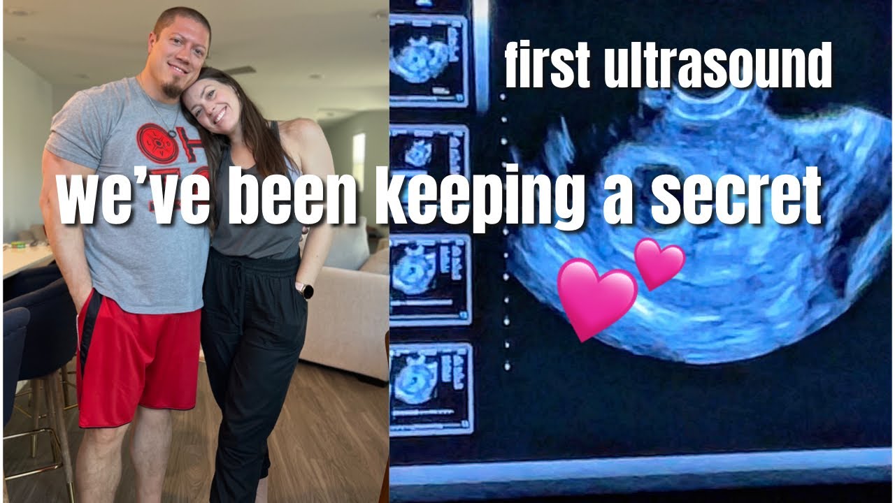 HUGE SHOCK!!😱 WE’RE HAVING TWINS?!!😱😳👶🏻👶🏻 First Ultrasound After Our Frozen Embryo Transfer
