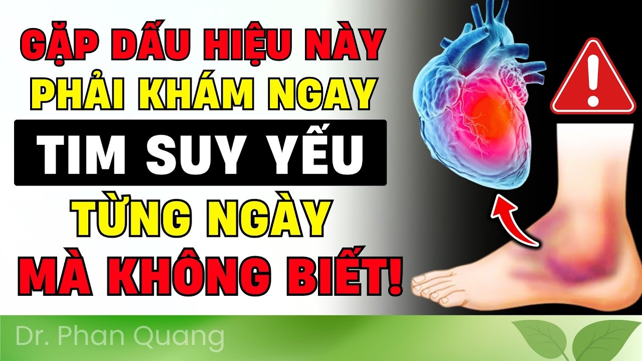 🔴 CẢNH BÁO! 7 Dấu Hiệu ÂM THẦM Tim Suy Yếu, Ai Cũng Dễ Bỏ Qua (CẦN BIẾT NGAY!) | Dr Phan Quang