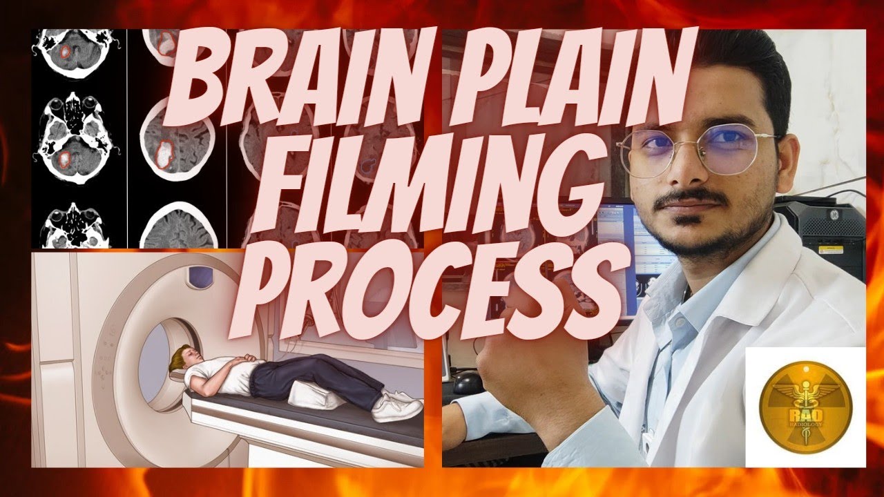 CT SCAN Brain plain filming process || 