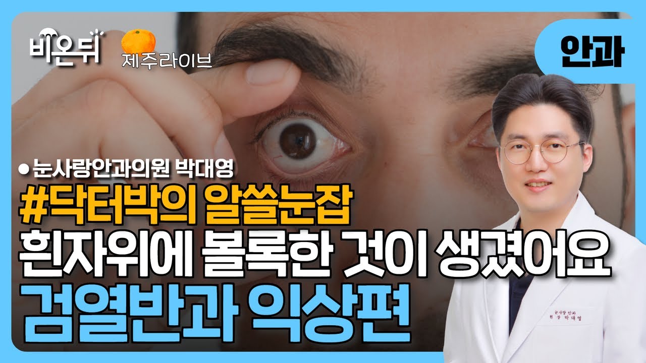 [제주] 닥터박의 알쓸눈잡 - 흰자위에 볼록한 것이 생겼어요! '검열반'과 '익상편' / 눈사랑안과의원 박대영