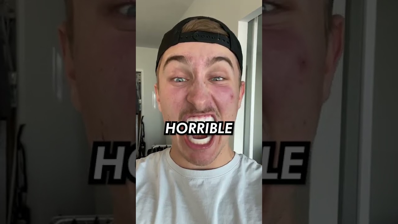 DOES TEETH WHITENING ACTUALLY WORK?🦷