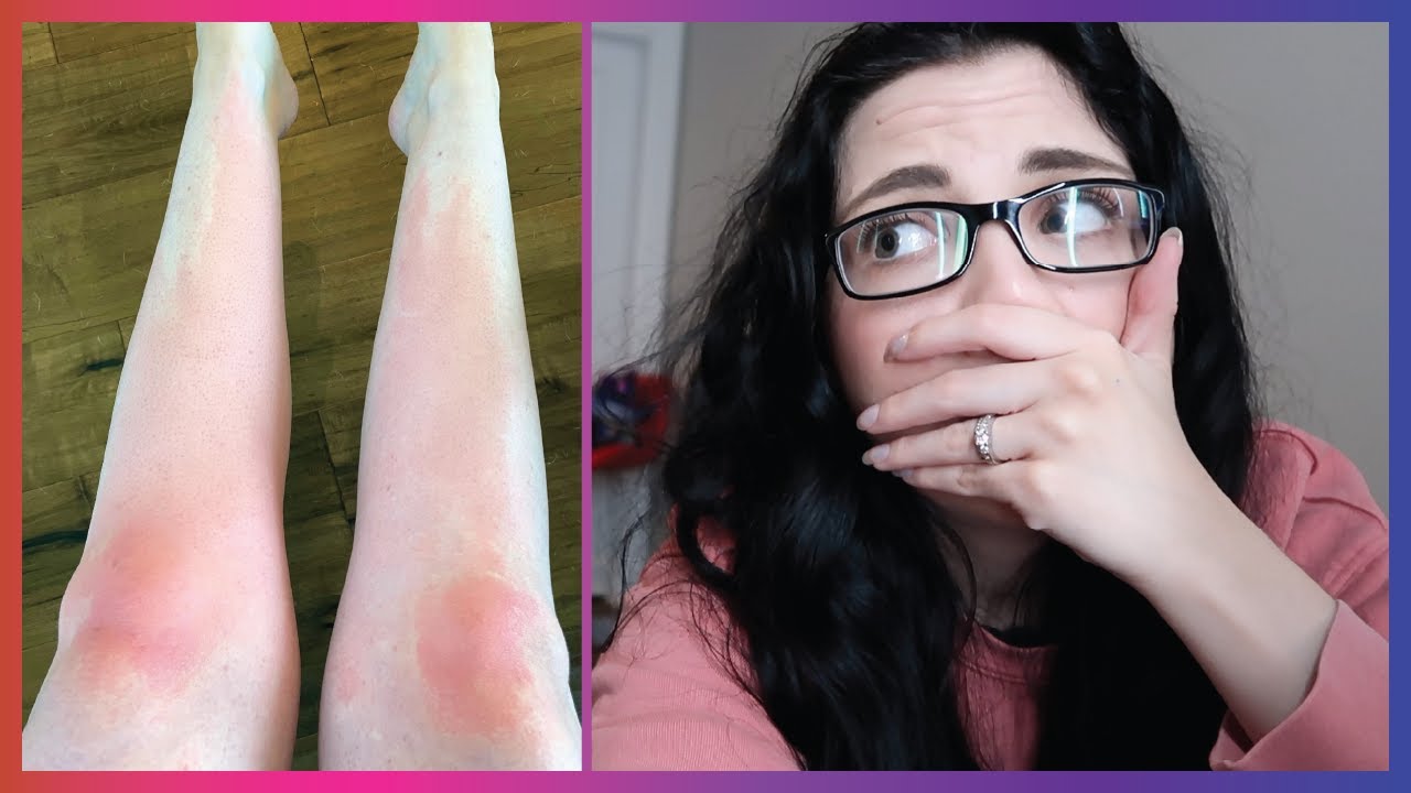 Jessii's Mysterious Health Emergency