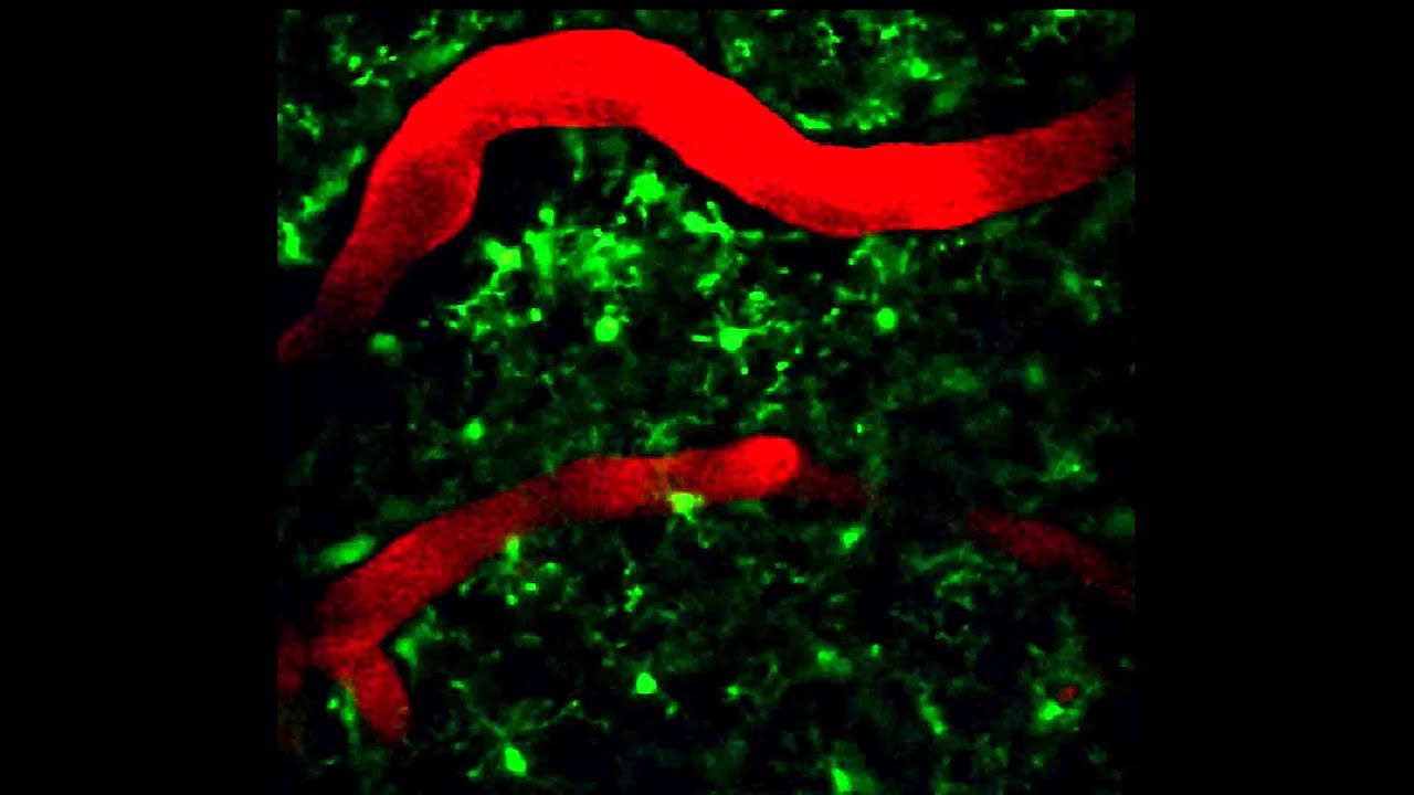 Toxoplasmosis research shows implications of how Zika may pass through blood brain barrier