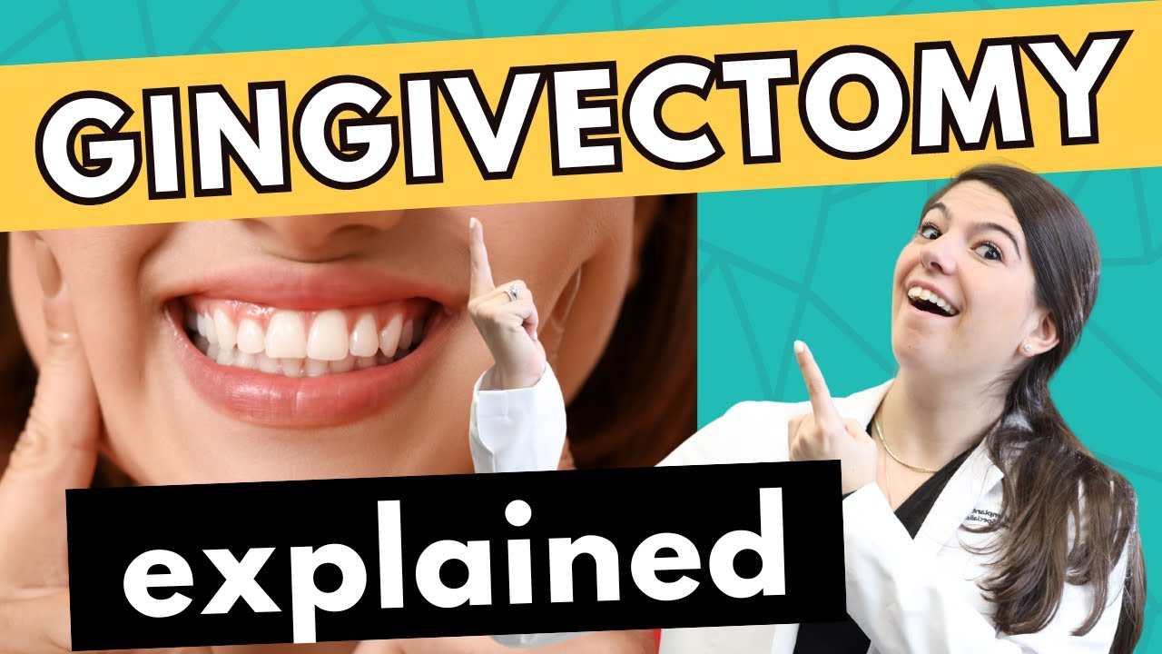 What is a Gingivectomy? | Dr. Rachel Miro