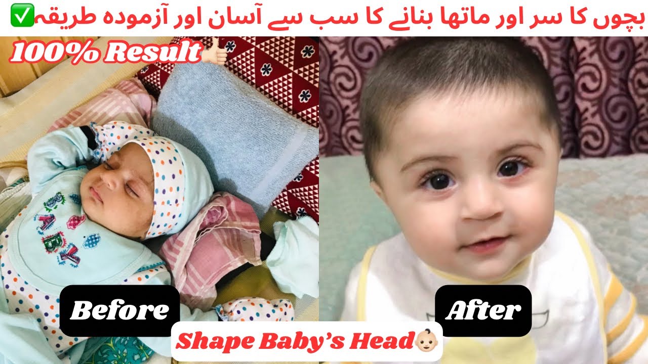 How to shape Baby’s Head & Forehead 👶🏻||بچے کا سر بنانے کا آسان طریقہ✅|| 💯 Results