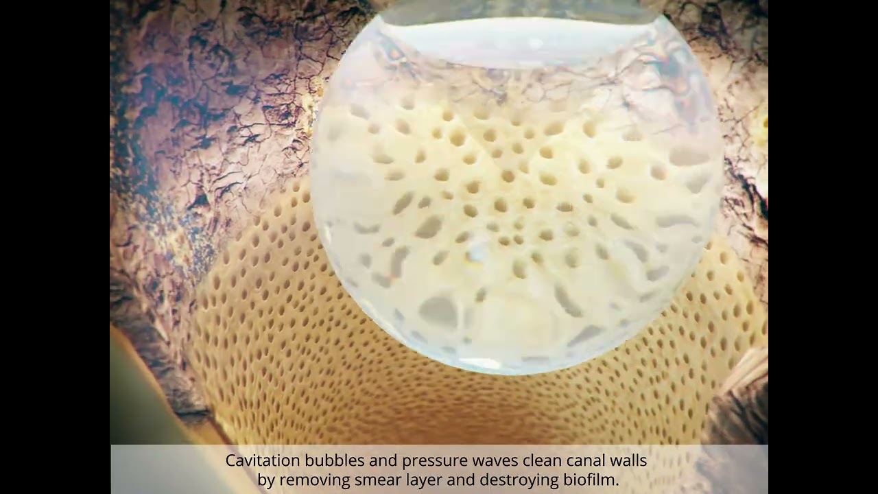 Omni Endodontics - Rapid Endo