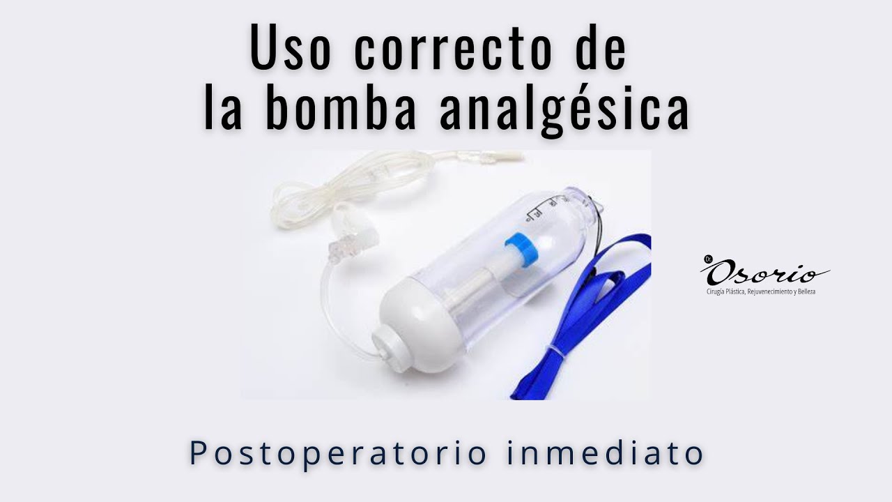 Uso correcto de la bomba analgésica
