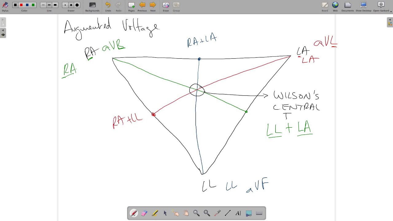ECG Theory Leads Einthoven Wilsons Central Terminal Placement
