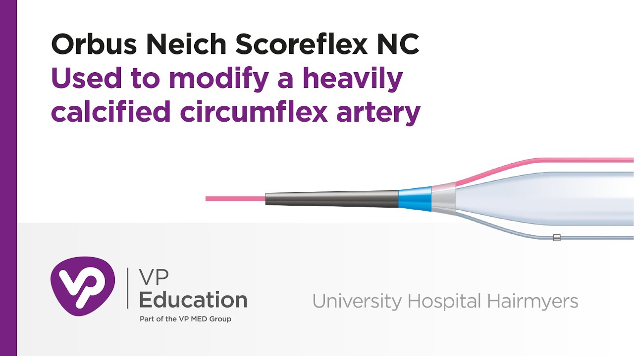 Orbus Neich Scoreflex NC Used to modify a heavily calcified circumflex artery