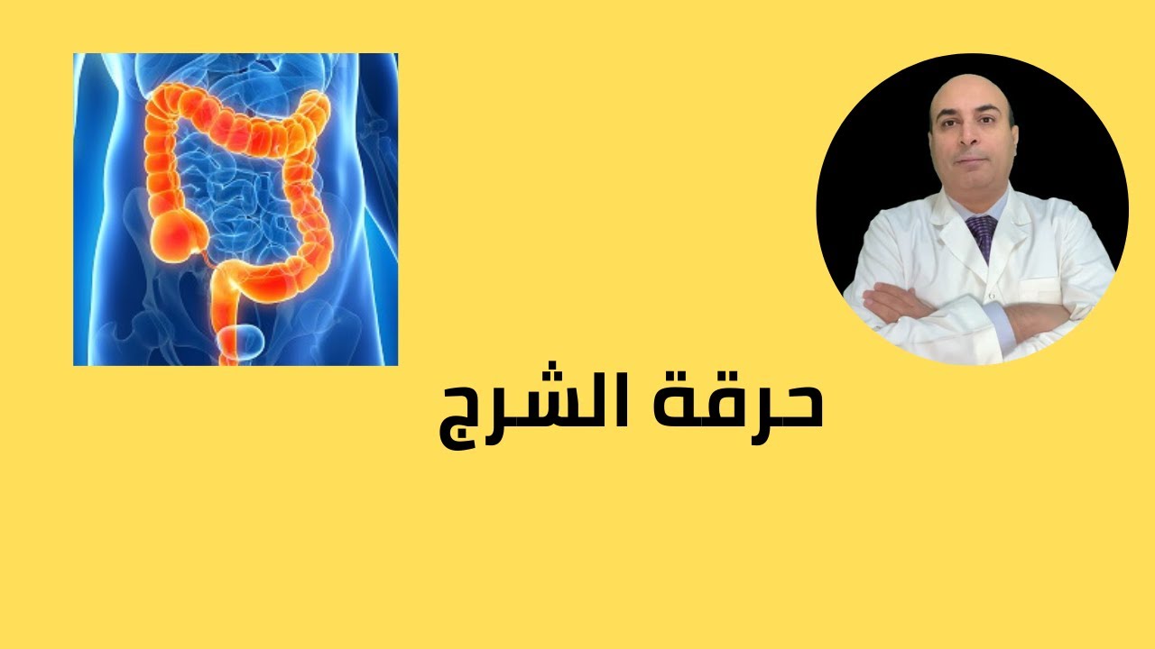 حرقه الشرج