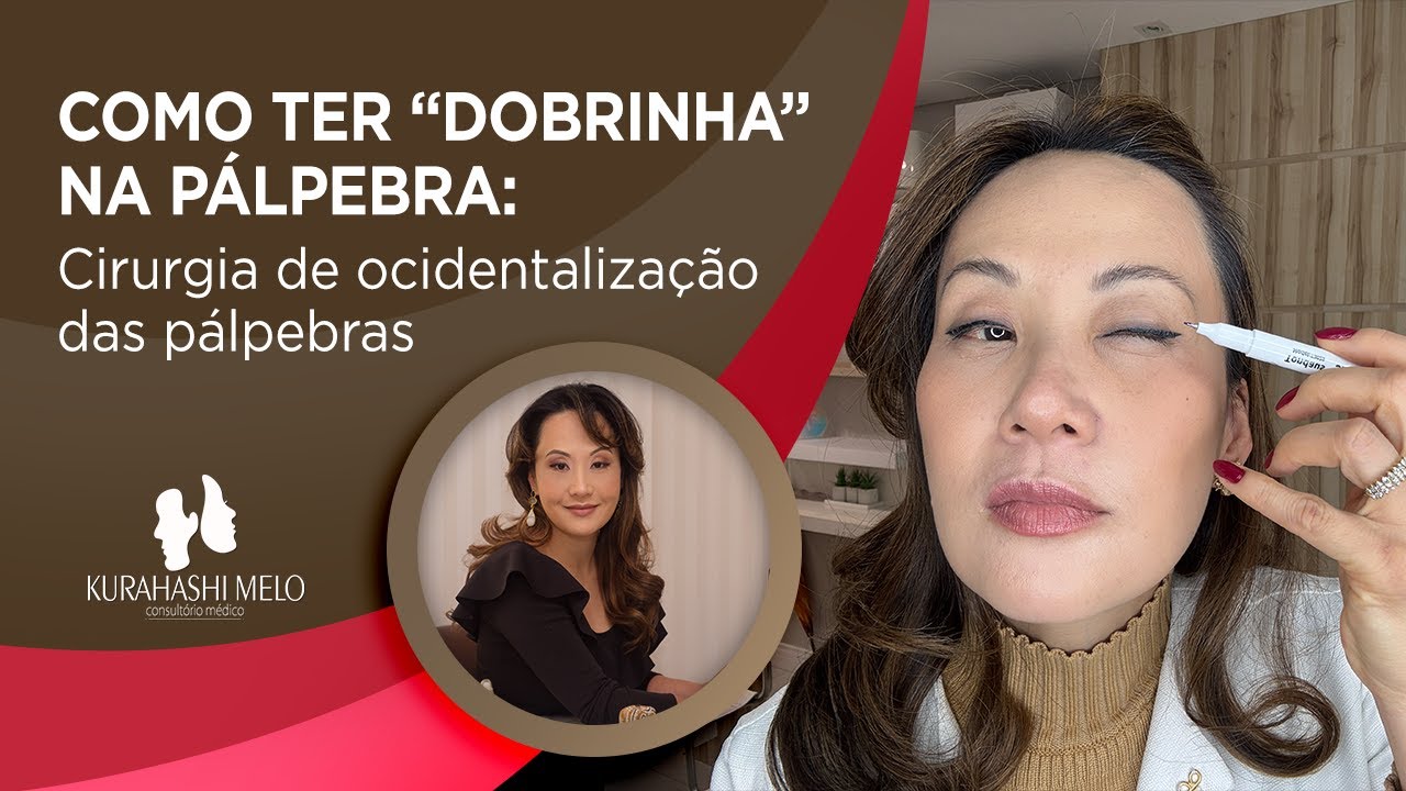 Cirurgia de Ocidentalização Asiática: Prega Supratarsal em 10 Dias