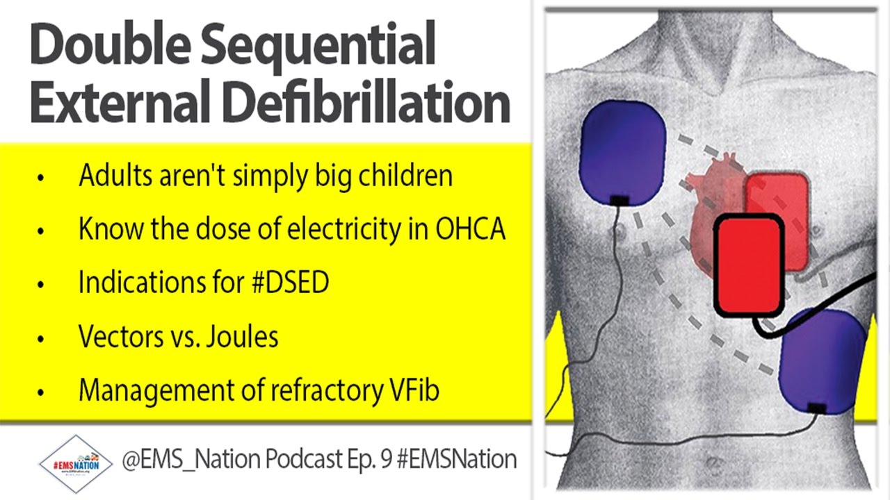 EMSNation Ep. #9: Simulation - Double Sequential Defibrillation in refractory VF & Lecture