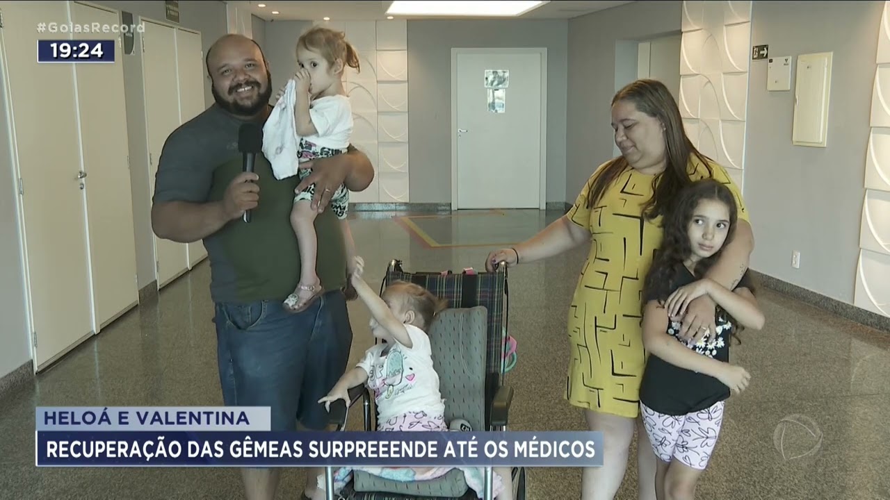 HELOÁ E VALENTINA: RECUPERAÇÃO DAS GÊMEAS SURPREEENDE ATÉ OS MÉDICOS