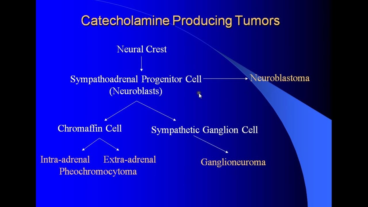 Pheochromocytoma | Epidemiology Signs Symptoms Diagnose and management | Ample Medical Lectures