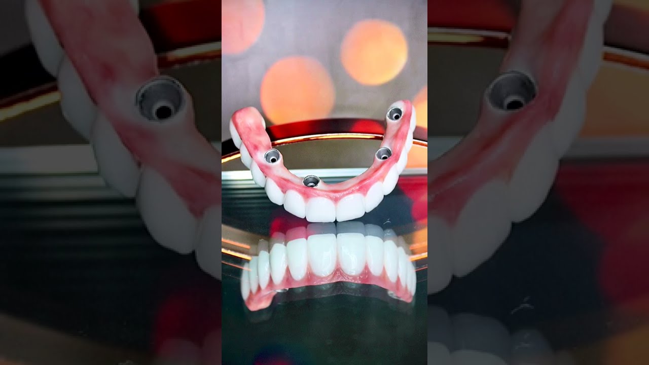 Protocolo Dentário - A melhor Prótese Dentária que existe! #Shorts