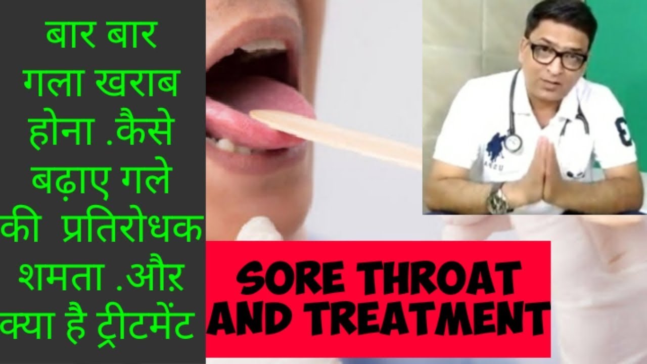 Tteatment of sore throat .कैसे बढ़ाए प्रतिरोधक(immunity) शमता अपने गले की