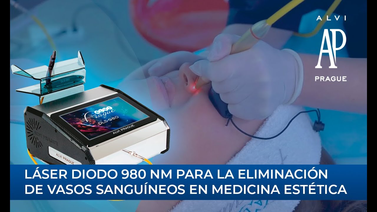 Láser diodo 980 nm para la eliminación de vasos sanguíneos en medicina estética