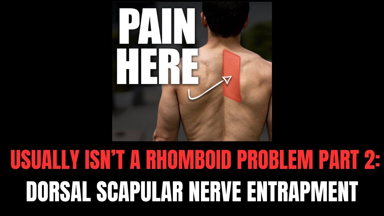 Mid Back Pain Usually Isn’t A Rhomboid Problem Part 2: Dorsal Scapular Nerve Entrapment.