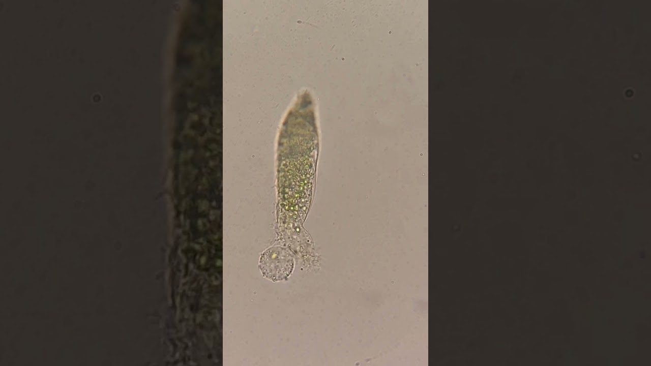 Death of a Ciliate 😞