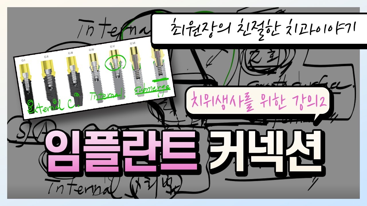 치과위생사를 위한강의2 임플란트 커넥션타입에 따른 힘의 분포