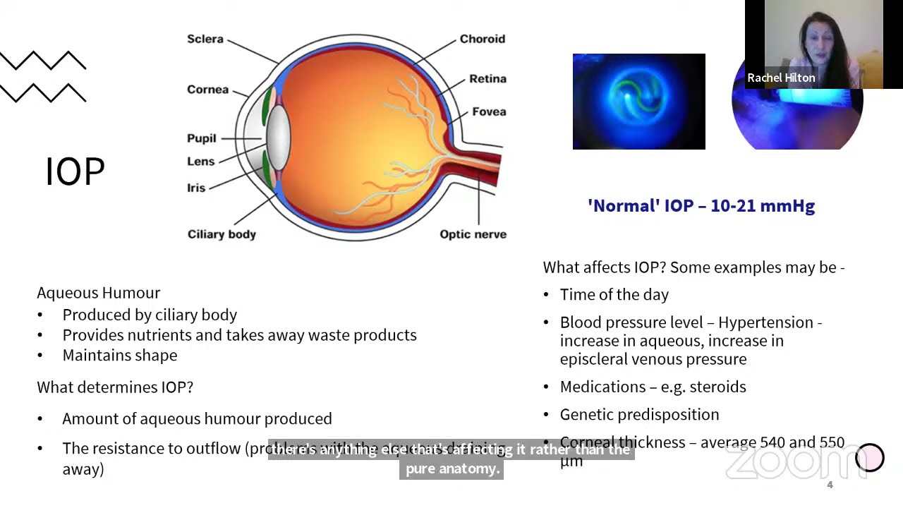 Digital glaucoma support group - Narrow angles and primary angle closure glaucoma