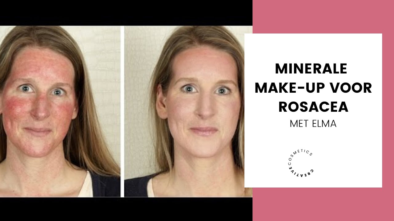 Minerale make-up voor Rosacea || Creative Cosmetics