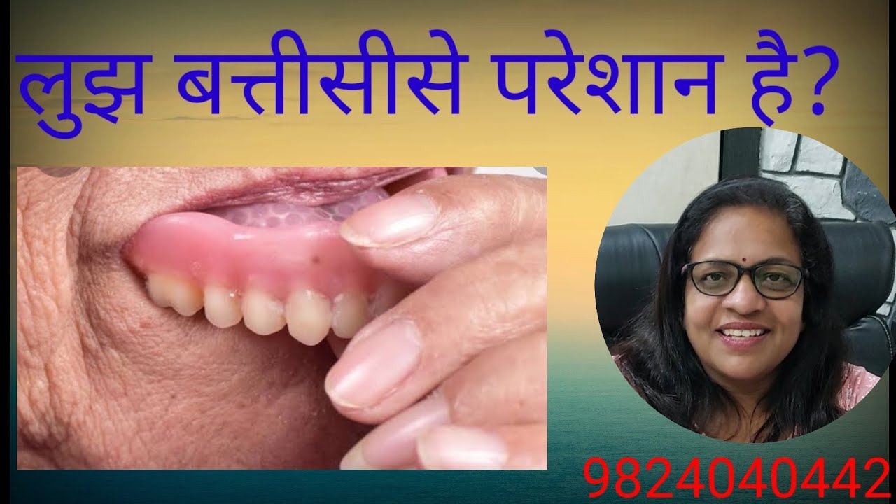 Facing problem with loose denture?solution||लुझ बतीसीका इलाज||ढीली बतीसीको टाइट कैसे करे||नकली दांत