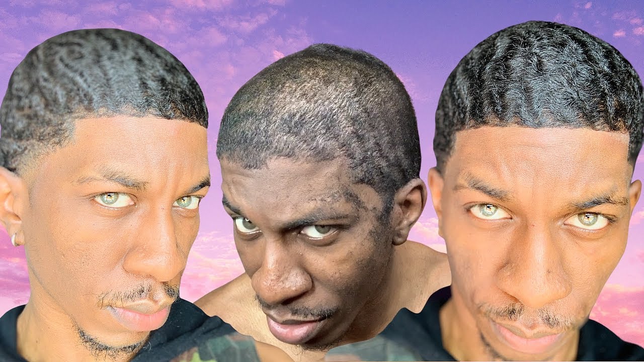 SIR CRUSE 360 Waves To 720 Waves : 4 Weeks After The Scalp! *MAJOR PROGRESS* 😱😱