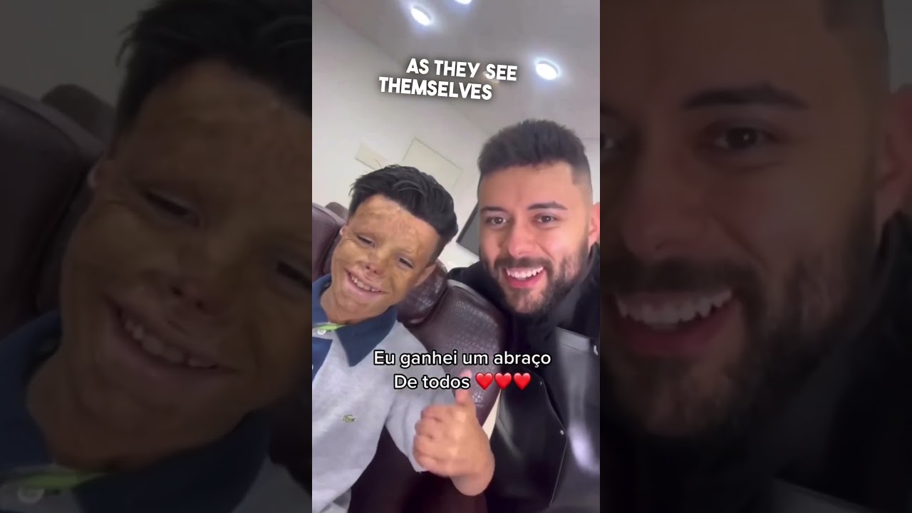This barber helped children get their hair back ❤️ @Franciscoprotesecapilar
