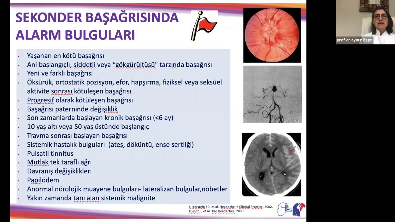 1. Basamakta Nöroloji - Başağrısı