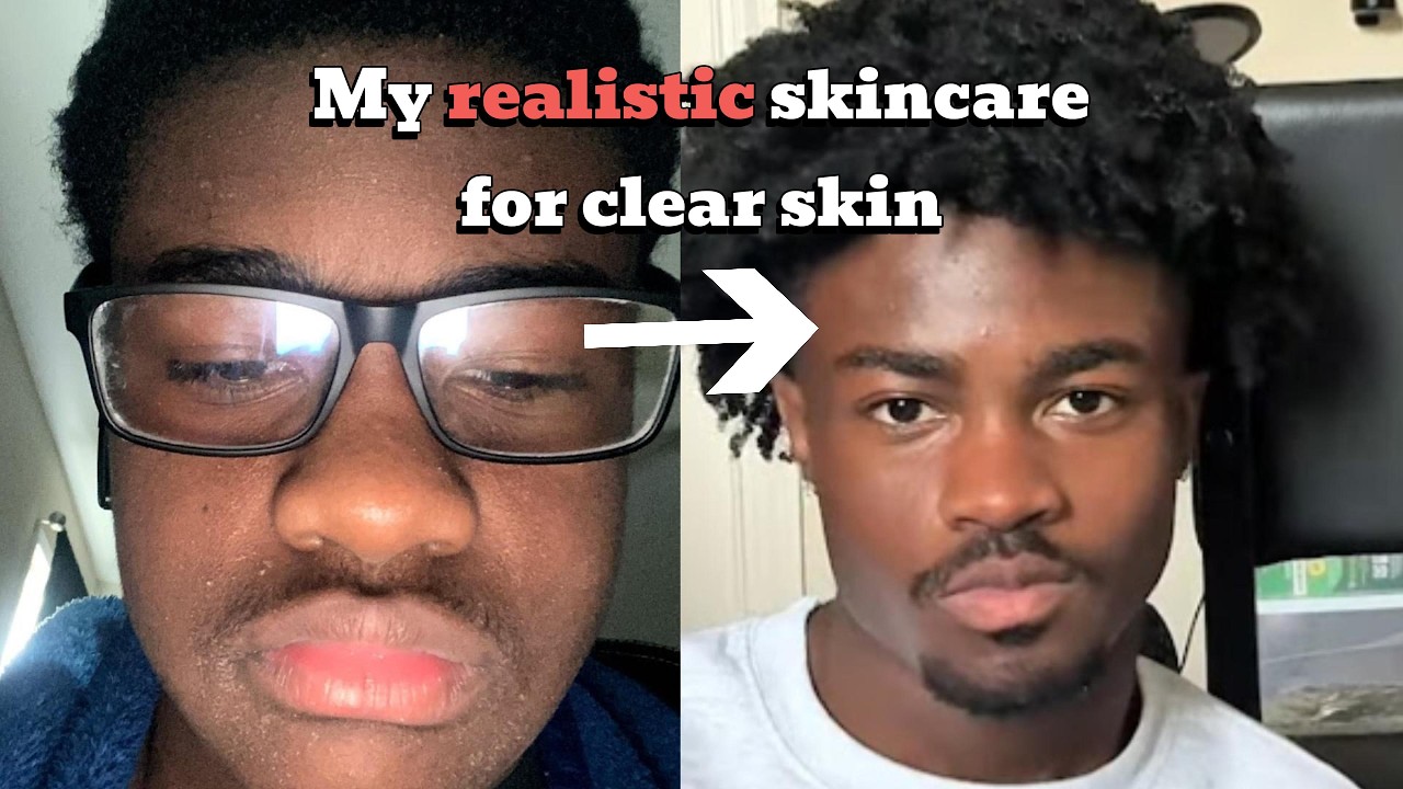 All you need for clear skin (realistic and affordable)