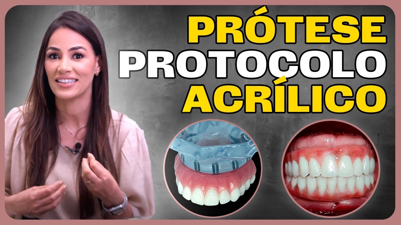 As ETAPAS DA PROTESE PROTOCOLO EM ACRÍLICO!