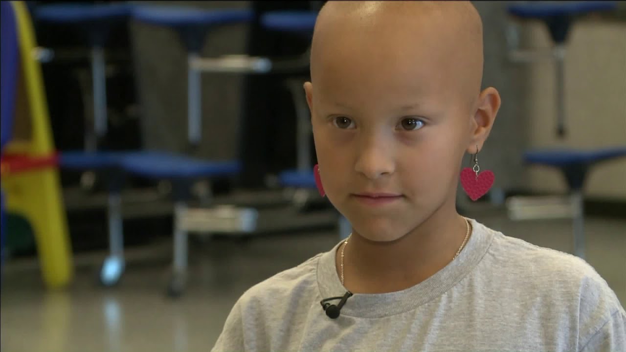 Losing your hair can be tough, especially as a kid