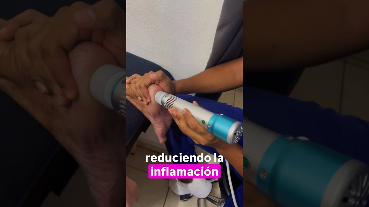 ONDAS DE CHOQUE PARA ESPOL&Oacute;N CALC&Aacute;NEO #foot #anatomy #medico #belleza #tips #pie #doctor