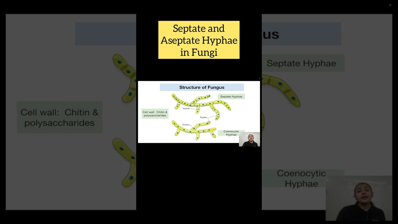 Septate and Aseptate Hyphae in Fungi | Kingdom Fungi | Biological Classification 