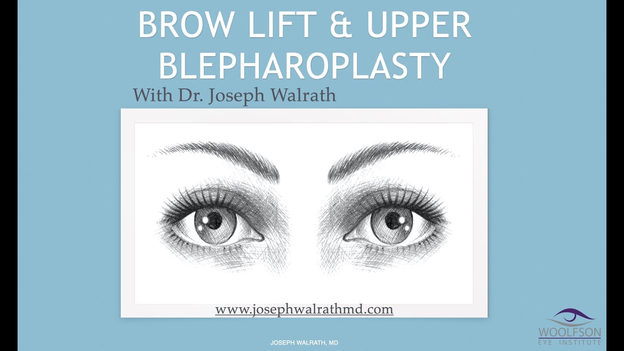 Upper Blepharoplasty and Brow Lift Surgery